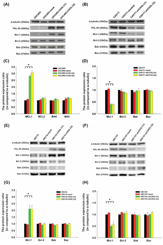 Western blot analysis of ovarian cancer (OVCAR3, CA5171) and endometrial cancer (HEC1b, HEC151) original cells and their transfectants.