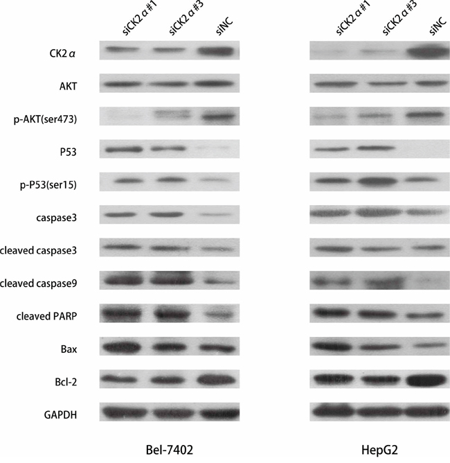 Detection of apoptosis-related proteins by western blotting.