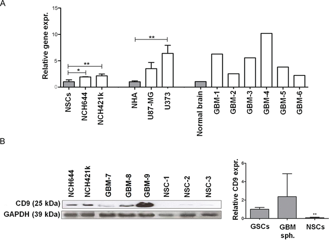 Expression of CD9 in GBM cells, GSCs cells and tissues.