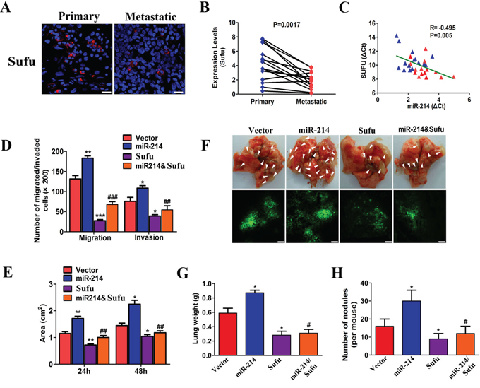 Sufu was a direct functional target of miR-214 in LAD metastasis.
