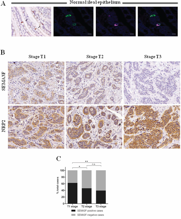 SEMA3F is differentially expressed in human endocrine cells.