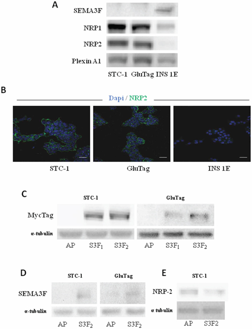 Expression of SEMA3F in intestinal endocrine tumoral cell lines.
