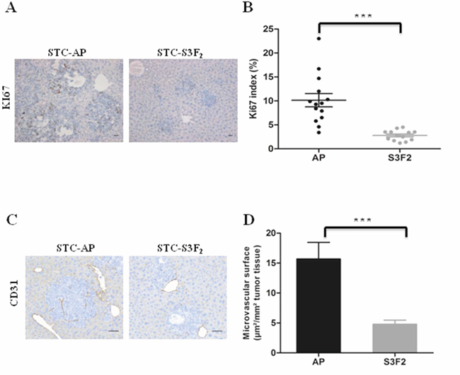 SEMA3F reduces the proliferation rate of tumor cells in vivo and inhibits tumor vascularization.