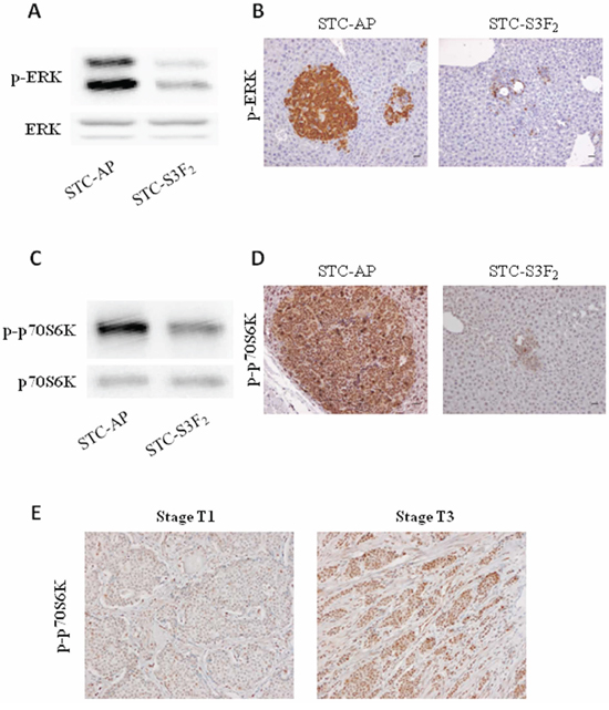 SEMA3F expression decreases activation of MAPK and mTOR signaling pathways.