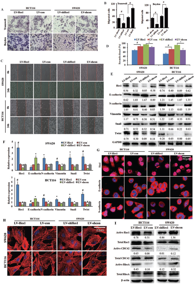 Effect of Hes1 expression on colon cancer cell migration and cell cytoskeleton organization.