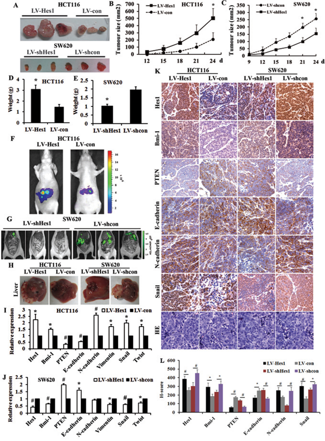 Hes1 enhances tumorigenicity and metastasis of colon cancer cells in vivo.