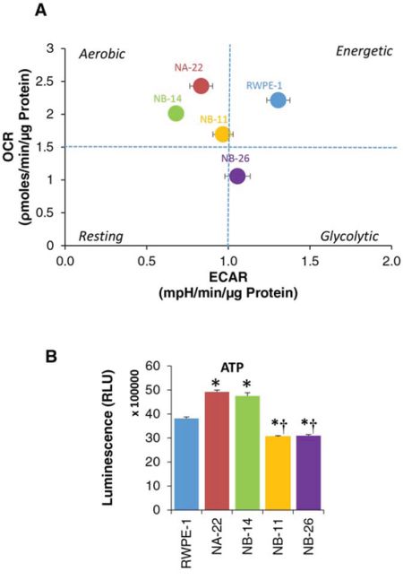 Metabolic phenotype and cellular ATP levels of RWPE-1 cells and its tumorigenic clones.