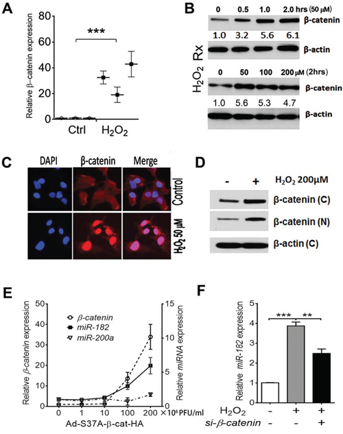 ROS or stress-induced miR-182 expression is regulated by &#x03B2;-catenin.
