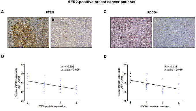PTEN and PDCD4 protein levels correlate with miR-21 expression in HER2-positive breast cancer.
