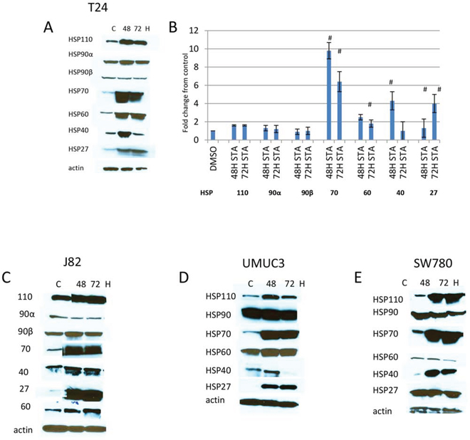 Expression of HSPs in human bladder cancer cells treated with HSP90 inhibitors.