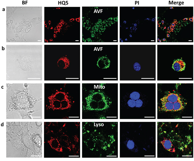 Confocal microscopic images of the localization of HQ5 in gambogic acid treated 4T1-luc2 cells.