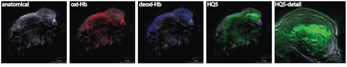 In vivo opto-acoustic imaging of necrosis of spontaneous 4T1-luc2 tumor necrosis with HQ5.