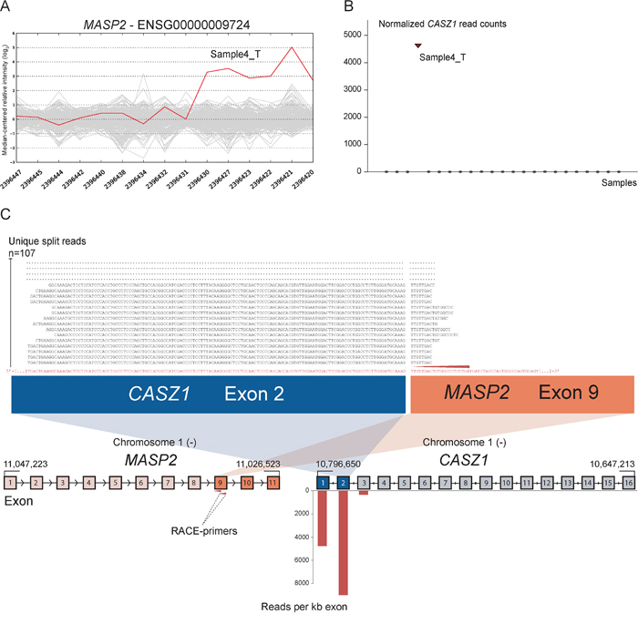Novel fusion between CASZ1 and MASP2 is in concordance with 3&prime; overexpression of MASP2.