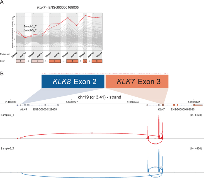 Read-through from upstream KLK8 to KLK7 in samples with deviating 3&prime; expression of KLK7.