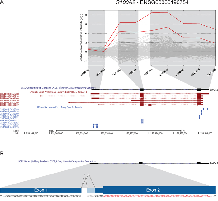 A novel 3&prime; splice-site in S100A2 is found to be overrepresented in CRC.