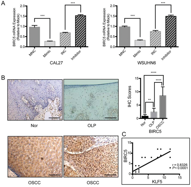 BIRC5 may constitute a downstream gene involved in miR-375/KLF5 regulated tumor premalignant progression.