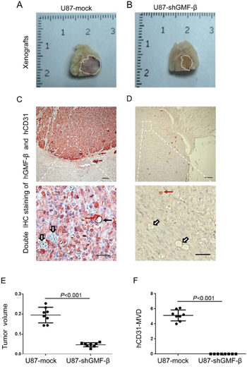 GMF-&#x03B2; knockdown suppresses tumor growth and the formation of human-CD31 positive microvessels (hCD31-MVs) in orthotopic U87 xenograft models.