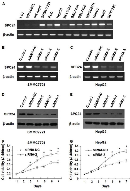 The inhibition of SPC24 decreased HCC cell growth.