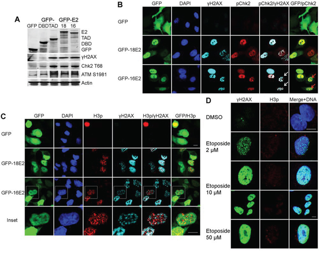 E2 induces a DNA damage signal in A549 cells arrested in prophase.