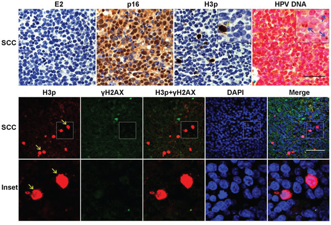 Metaphase but not prophase patterns of H3p expression in HPV16 associated SCC lesions.
