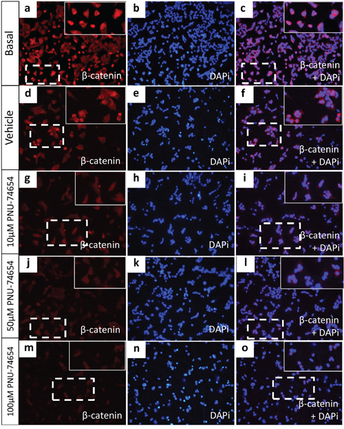 Beta-catenin immunofluorescence in the NCI-H295 cell line.