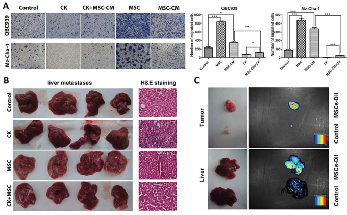 MSCs promote cholangiocarcinoma cancer metastasis.