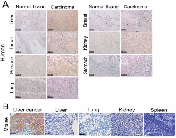 Immunohistochemical analysis of in vivo Frizzled-7 protein expression.