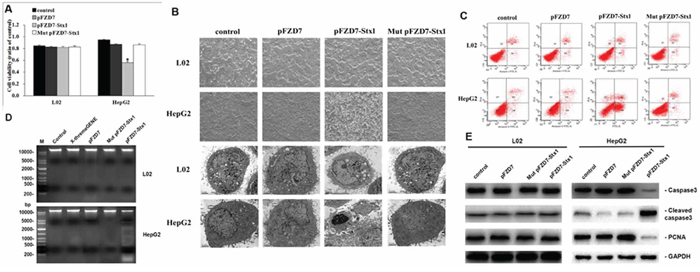 pFZD7-Stx1 transfection induced tumor cell apoptosis in vitro.