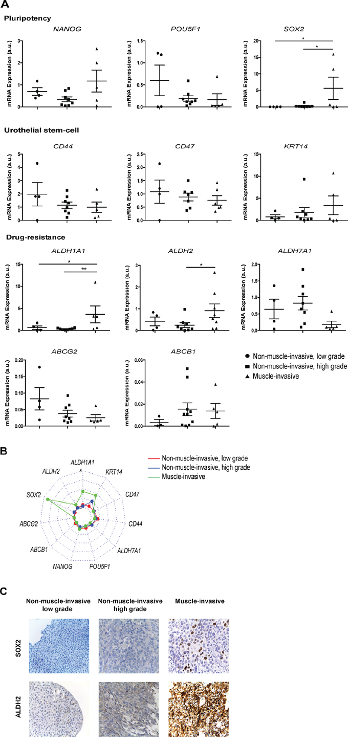 A two-gene stemness signature, SOX2 and ALDH2, discriminates muscle-invasive from non-muscle-invasive BC.