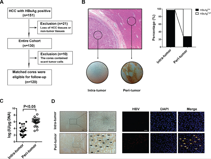 HBV infection in HCC tissues is lower than that in the surrounding liver tissue.