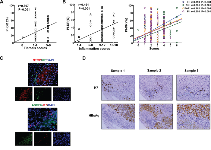 Scant expression of HBsAg and receptors on HPCs activated in inflammation microenvironment.