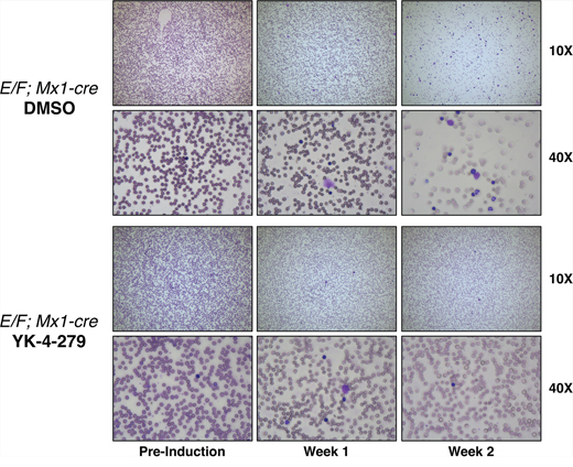 YK-4-279 reduced nucleated erythroblast cells in peripheral blood smears of mice with EWS-FLI1 induced leukemia.