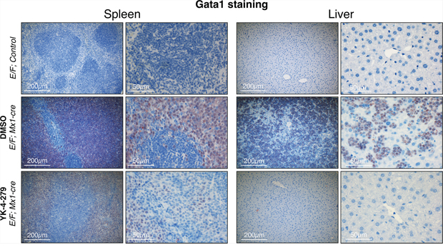 Gata1+ erythroblasts were effectively diminished in liver and spleen upon YK-4-279 treatment.