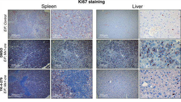 Decreased proliferation was observed in spleens and livers of YK-4-279 treated leukemic mice.