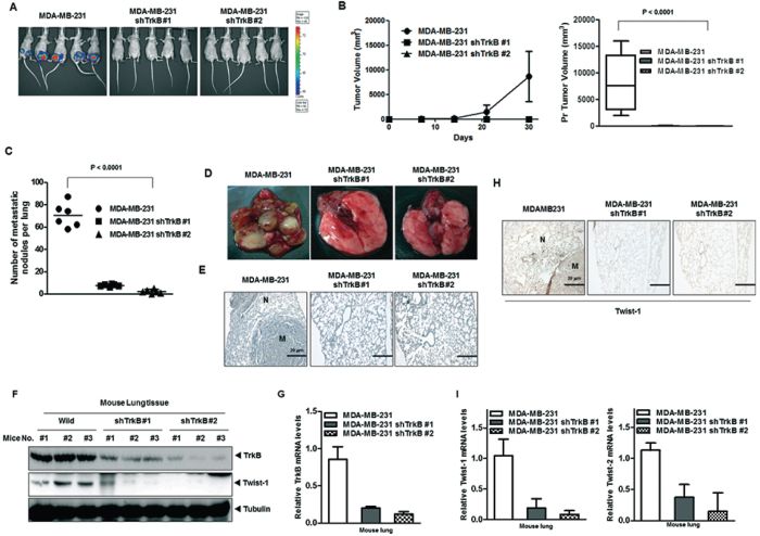 Suppression of TrkB expression inhibited metastasis from the mammary gland to the lung.