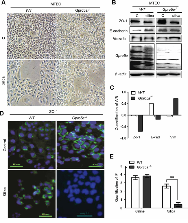 Silica induces EMT-like characteristics in Gprc5a&#x2212;/&#x2212; mouse tracheal epithelial cells (MTEC) in vitro.