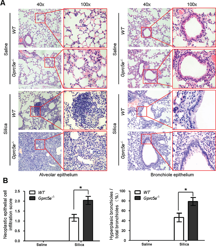 Epithelial neoplasia coincides with exacerbated tissue damage and fibrogenic response in silica-exposed lungs from Gprc5a&#x2212;/&#x2212; mice.