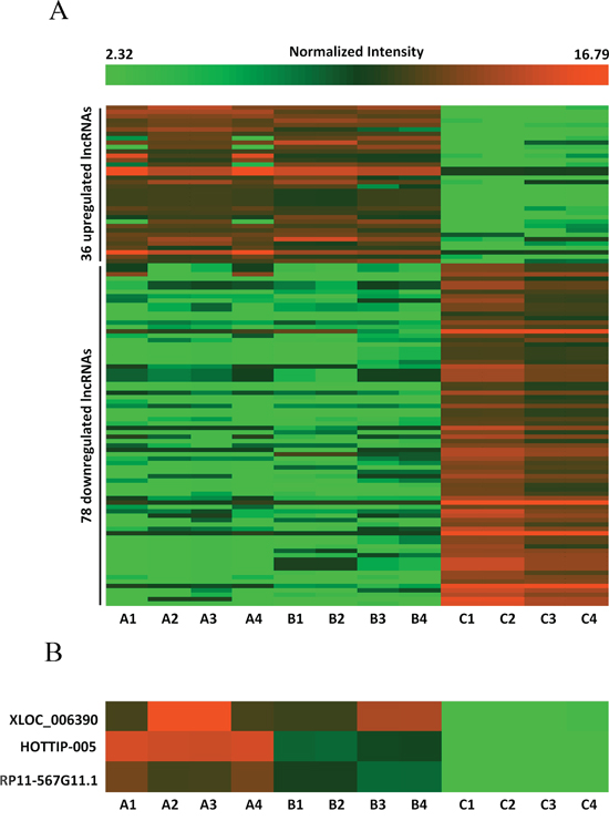 Differences in lncRNA expression profiles between PC and chronic pancreatitis tissues.