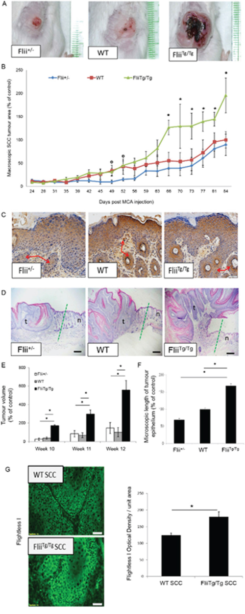 Overexpression of Flii results in severe SCC development.
