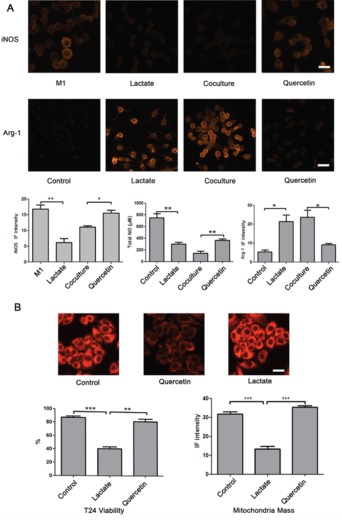 Effect of lactate shuttling on the re-education of macrophages by bladder cancer cells.