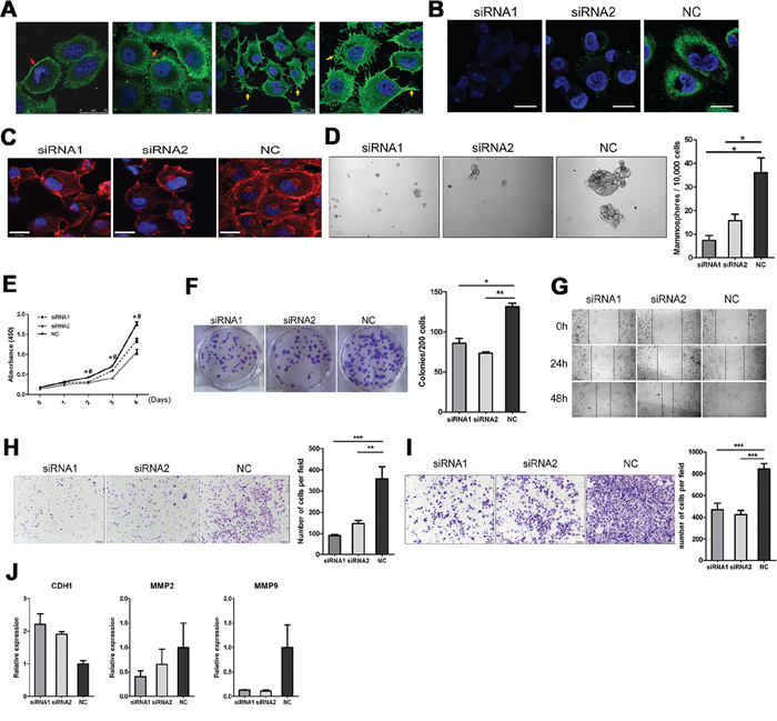 Sub-cellular localization of IgG showed on cancer cell surface, knockdown of IgG by siRNA targeting the heavy chain constant region of IgG reduces proliferation, migration, and invasion of the MDA-MB-231 cells.