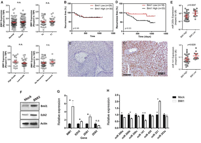 BMI1 protein levels associate with early recurrence in NMIBC and negatively correlates with miR-200 family expression.