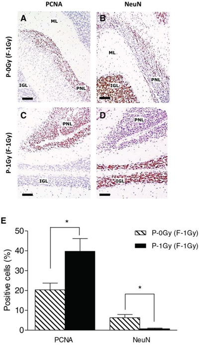 Paternal irradiation drives PNLs towards a more proliferative condition.