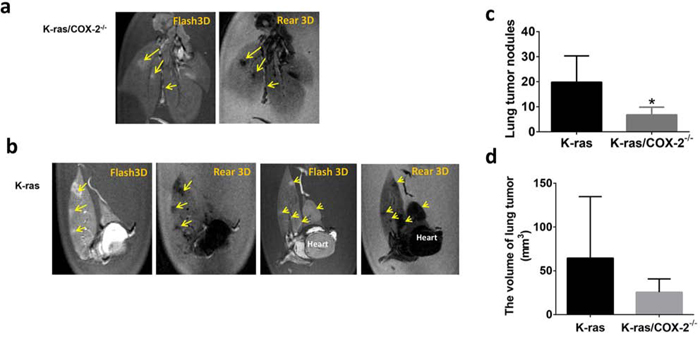 Knocking out COX-2 in mice with K-ras mutation significantly reduced the lung tumor development.