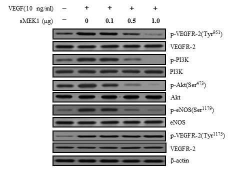 sMEK1 suppressed the phosphorylated proteins of the VEGFR-2/PI3K/eNOS signaling cascade.