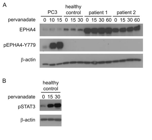 Activation of EPHA4 in CD4+ T-cells