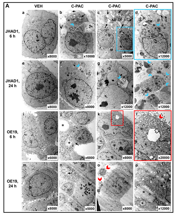 Effect of C-PAC on autophagy induction in EAC cells.