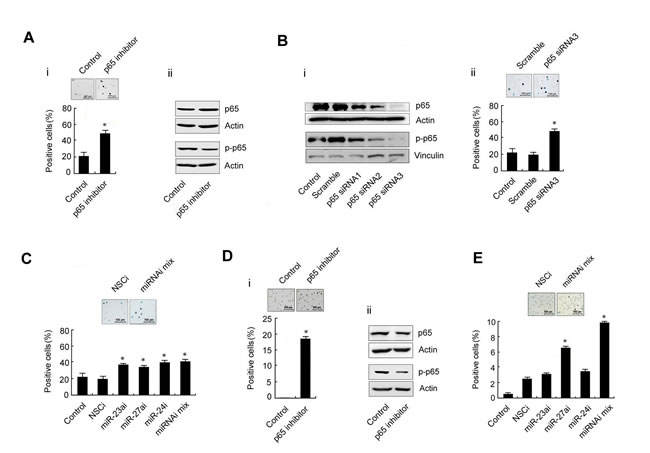 Differentiation of the human erythroleukemia cell lines K562 and HEL after treatment with a p65 inhibitor or transfection with p65-targeted siRNA or miRNA inhibitors.