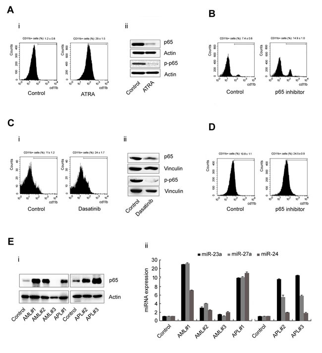p65 and miRNA expression in leukemia cell lines and nucleated peripheral cells from leukemia patients.