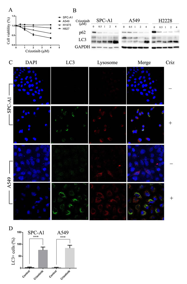 Crizotinib impairs cell viability and activates autophagy in multiple lung cancer cell lines.